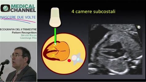 Guida All Ecografia Fetale Tutto Ci Che Devi Sapere Actualizado