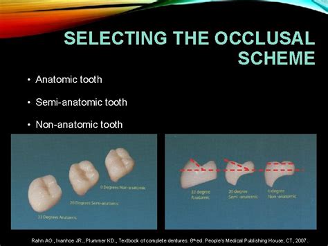 Occlusal Concepts Balanced And Nonbalanced Occlusion Incisal Guidance