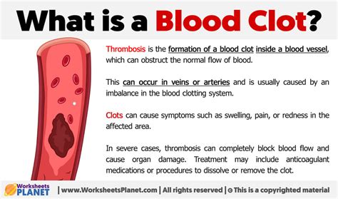 What is a Blood Clot | Thrombosis