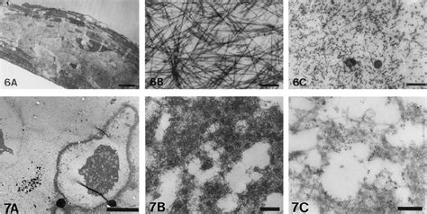 Electron Micrograph Of An Aggregate From Suspension Culture A Two