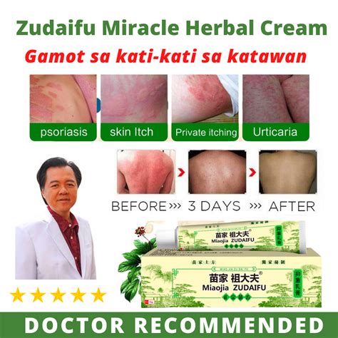 Natural Herbal Skin Psoriasis Cream Dermatitis Eczematoid Eczema