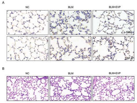 EVP Treatment Reduced Fibroblast Activation Level And Protected Lung