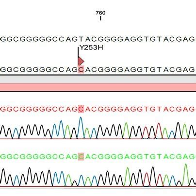 BCR-ABL KD mutation spectrum in CML patients with IM-resistance ...