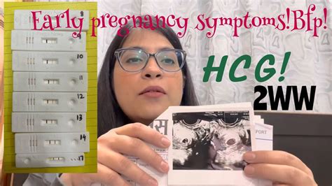 Early Pregnancy Symptoms Hcg Levels 8 Dpo Bfp Line Progression 8