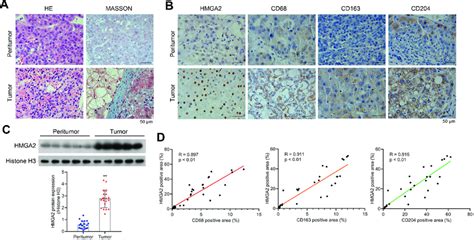 Hmga Is Upregulated In Human Hcc Tissues And Is Positively Correlated