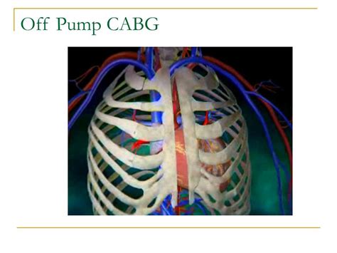 heart lung machine pump functions  components powerpoint