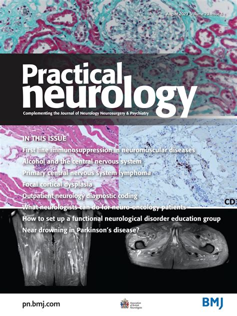 Rhabdomyolysis Encephalopathy Epilepsy And Cardiac Arrhythmia