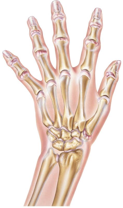 Main Rhumatisme Articulaire Des Joints Illustration Stock