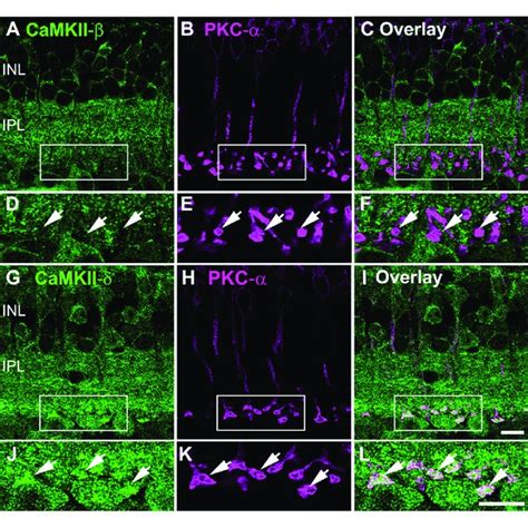 CaMKII β and δ expression in different types of cone biplar cells