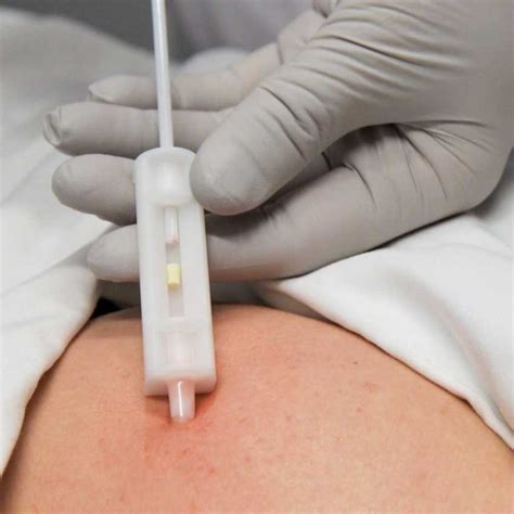 Hormone Pellet Therapy Insertion In Miami Healthy Me Medical