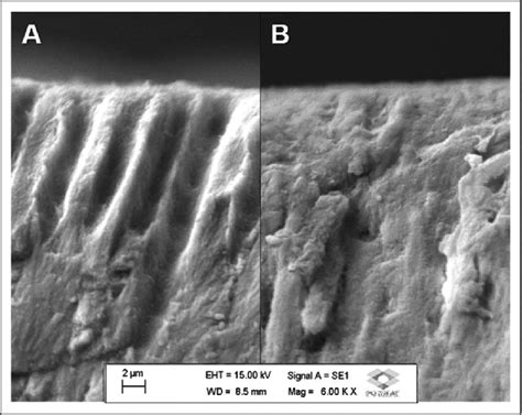 Scanning electron micrographs of the morphological analysis of the ... 
