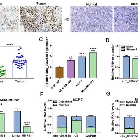 The Expression Level Of Circ 0000527 In TNBC Tissues And Cells A The