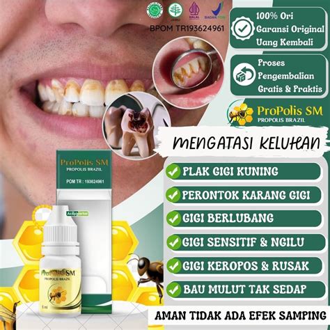 Jual Propolis Herbal Obat Plak Gigi Pembersih Gigi Kuning Perontok