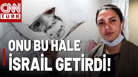 Ağzında Emzik Bedeni Sargılı Onu Bu Hale İsrail Getirdi Fulya Öztürk