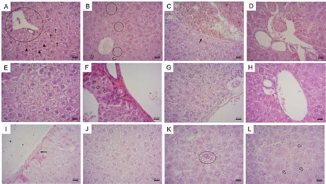 Hande Liver Histology A Female Negative Control Group Normal Liver Download Scientific