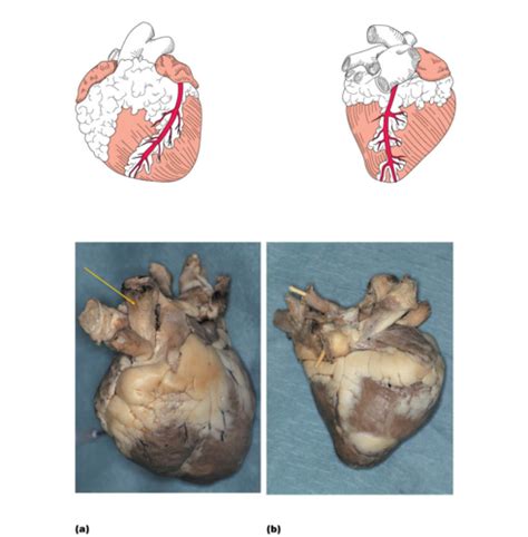 Heart Dissection Label Flashcards Quizlet