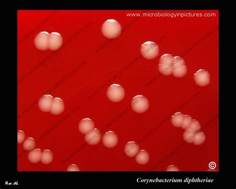 Corynebacterium On Blood Agar