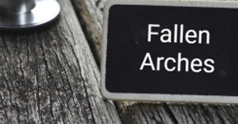 All About Fallen Arches Facty Health