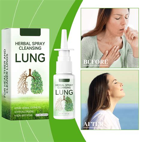 Mjkmart Qingfei Nasal Spray Nasal Congestion Smooth Breathing Health