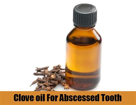 8 Natural Home Remedies For Treating Tooth Abscess Common Causes And Symptoms Of Abscessed