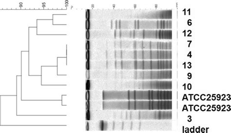 Dendrogram Using Pfge Profiles Of Smai Digested Genomic Dna Of Nine S