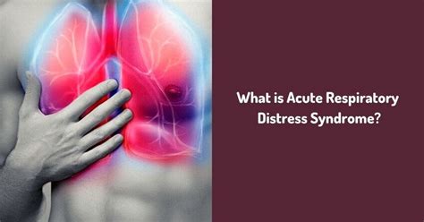 What Is Acute Respiratory Distress Syndrome