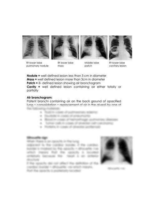 SOLUTION: Chest radiography - Studypool