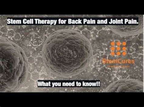 Stem Cell Therapy For Back Pain And Joint Pain Truths And Myths