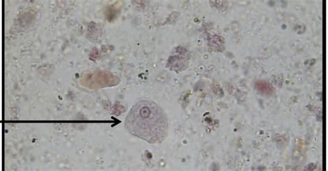 Micro Lab Kingdom Protista Parasites Flashcards Quizlet