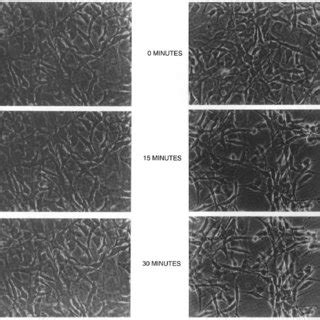 Morphological Response Of MC 3T3 E1 Mouse Osteoblastic Cells To