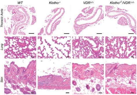 Upper Panel Shows Representative Von Kossa Stained Sections Download Scientific Diagram