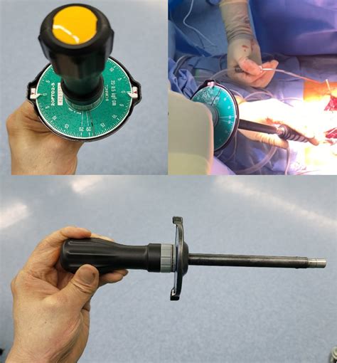 Figure 1 From Screw Insertional Torque Measurement In Spine Surgery