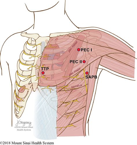 Regional Techniques For Cardiac And Cardiac Related Procedures