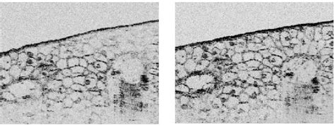 Figure 5 From Ultrahigh Resolution Optical Coherence Tomography Using A