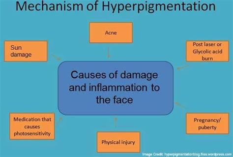 Know The Causes Symptoms And Treatments Of Hyperpigmentation