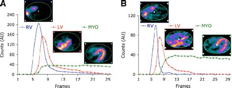 Figure From Reproducibility And Accuracy Of Quantitative Myocardial