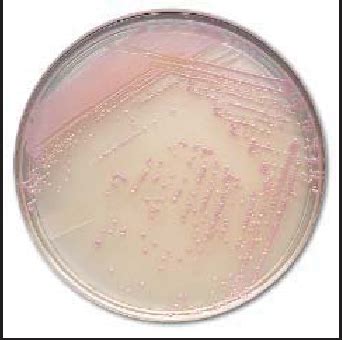 Figure From Comparison Of Bbl Chromagar Mrsa To Conventional Media