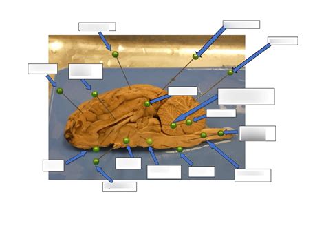 Sheep Brain Dissection Pt6 Diagram Quizlet