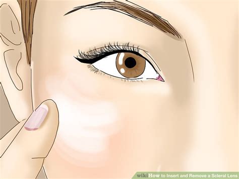 How To Insert And Remove A Scleral Lens With Pictures Wikihow