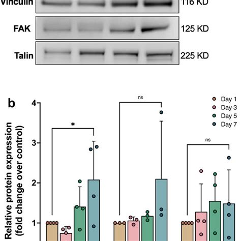 Vinculin Fak And Talin Expression Increase During Hsc Activation A