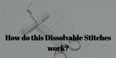 How Do Dissolvable Stitches Work Health Linear