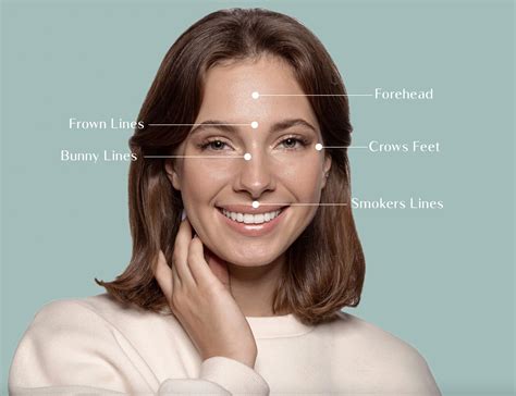 Most Common Anti Wrinkle Injection Areas Eden Medical Clinic