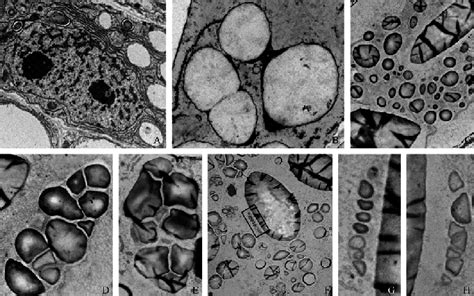 Structures Of Starch Granules In Endosperm Cells With Ga Oso 4 Fixation