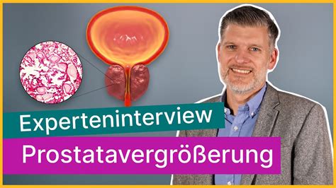 Welche Behandlungsmöglichkeiten gibt es bei einer vergrößerten Prostata