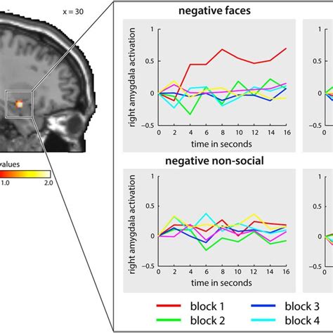 The Time Course Of Amygdala Activation For Negative Upper Left And