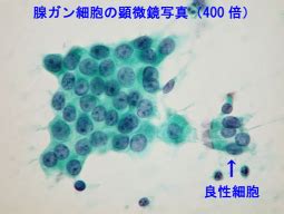 検査技術部/病理検査室 - 埼玉県立循環器・呼吸器病センター