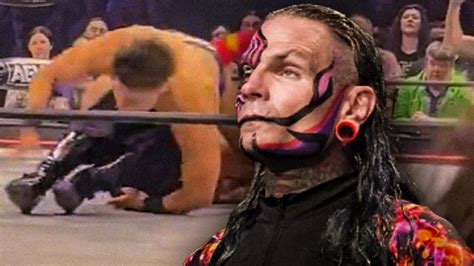 Jeff Hardy Has Slow Process To Endure Before AEW In Ring Return After