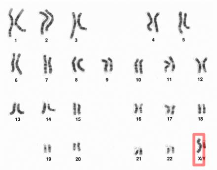 X chromosome - Wikipedia