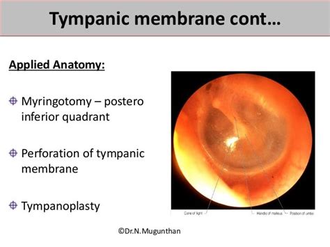 Tympanic Membrane Histology