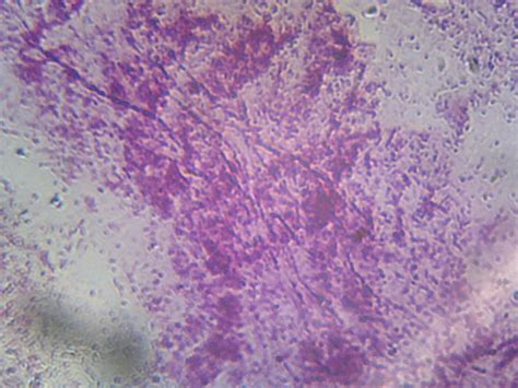 Pseudomonas Gram Stain Morphology